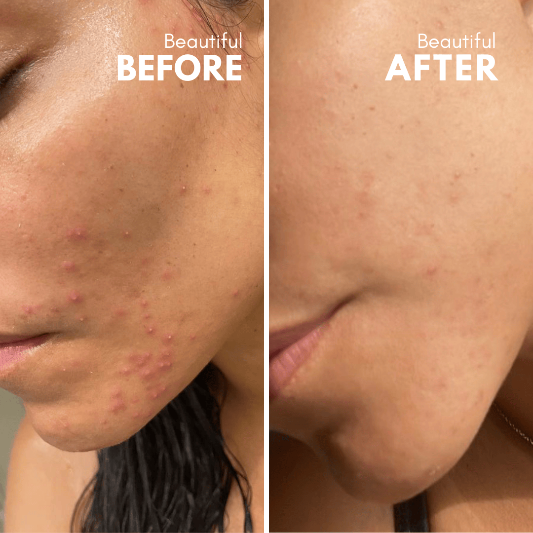 Apokathario | Exfoliant Naturel