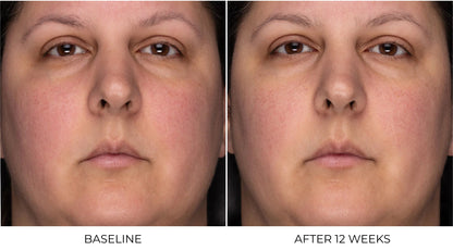 ZO Skin Health Recovery Crème