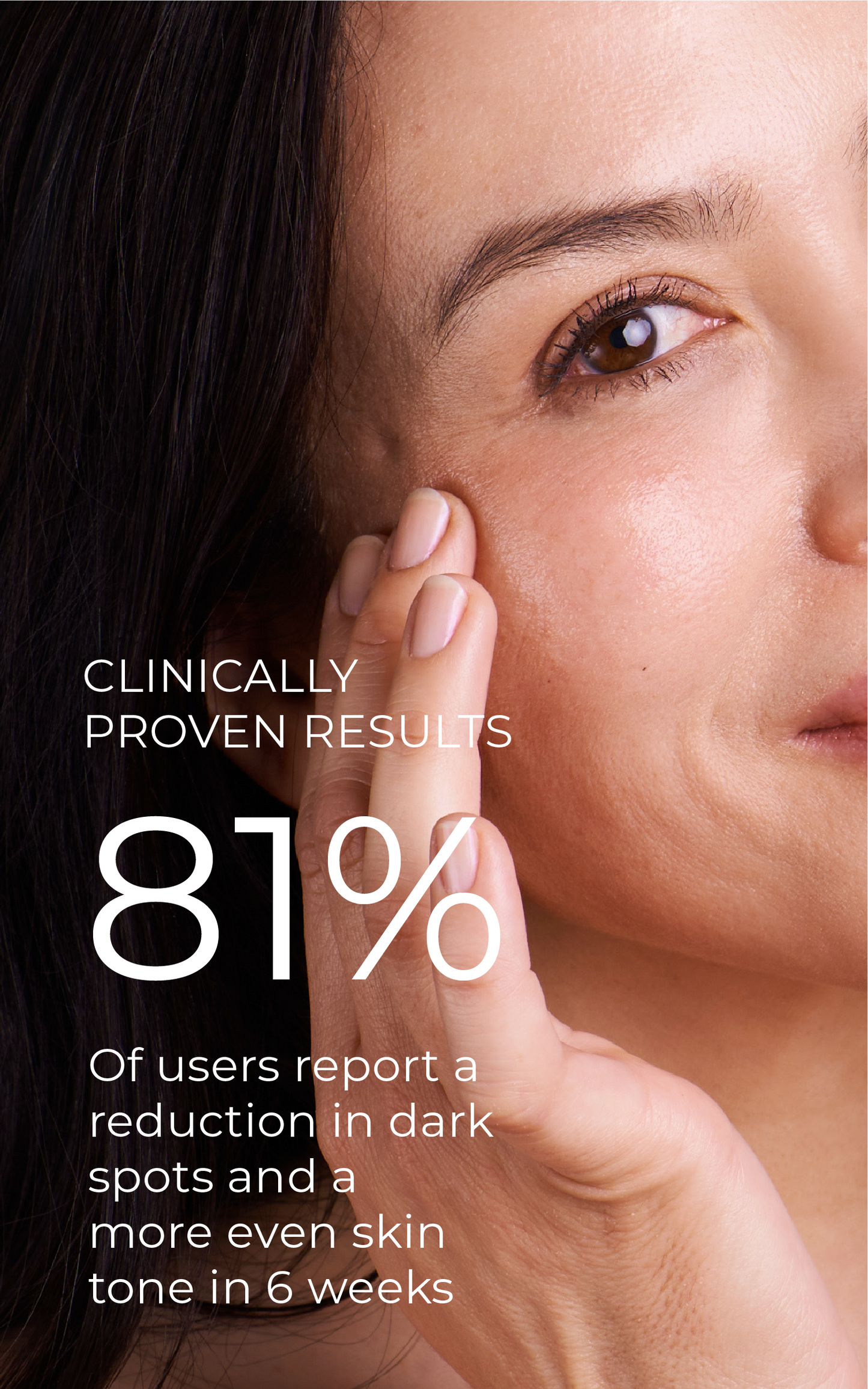 3-Step Solution For Dark Spots