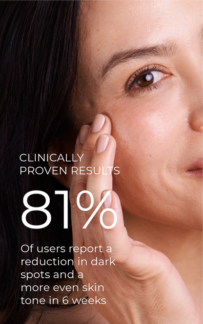 3-Step Solution For Dark Spots