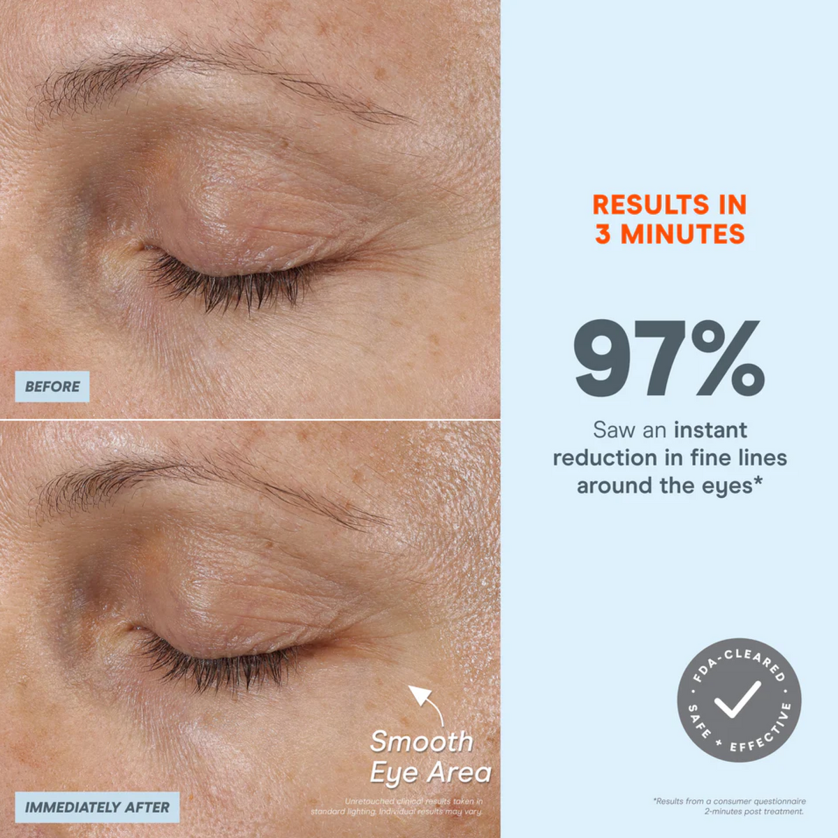 NuFACE FIX MicroWand