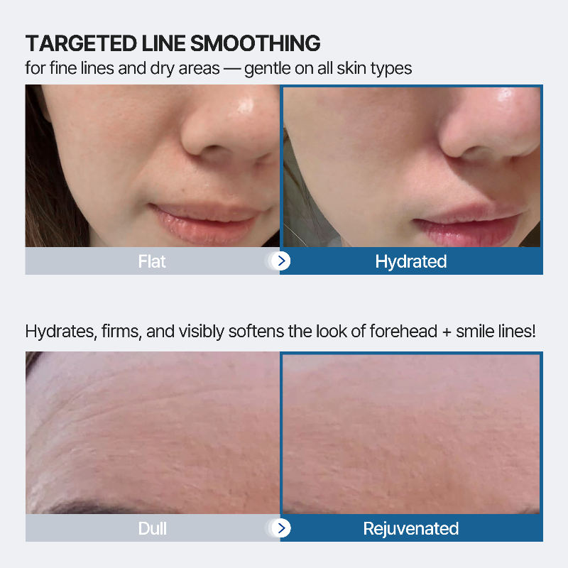 Forehead and Smile Line Wrinkle Patches
