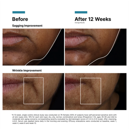 SkinCeuticals AGE Interrupter Ultra Serum