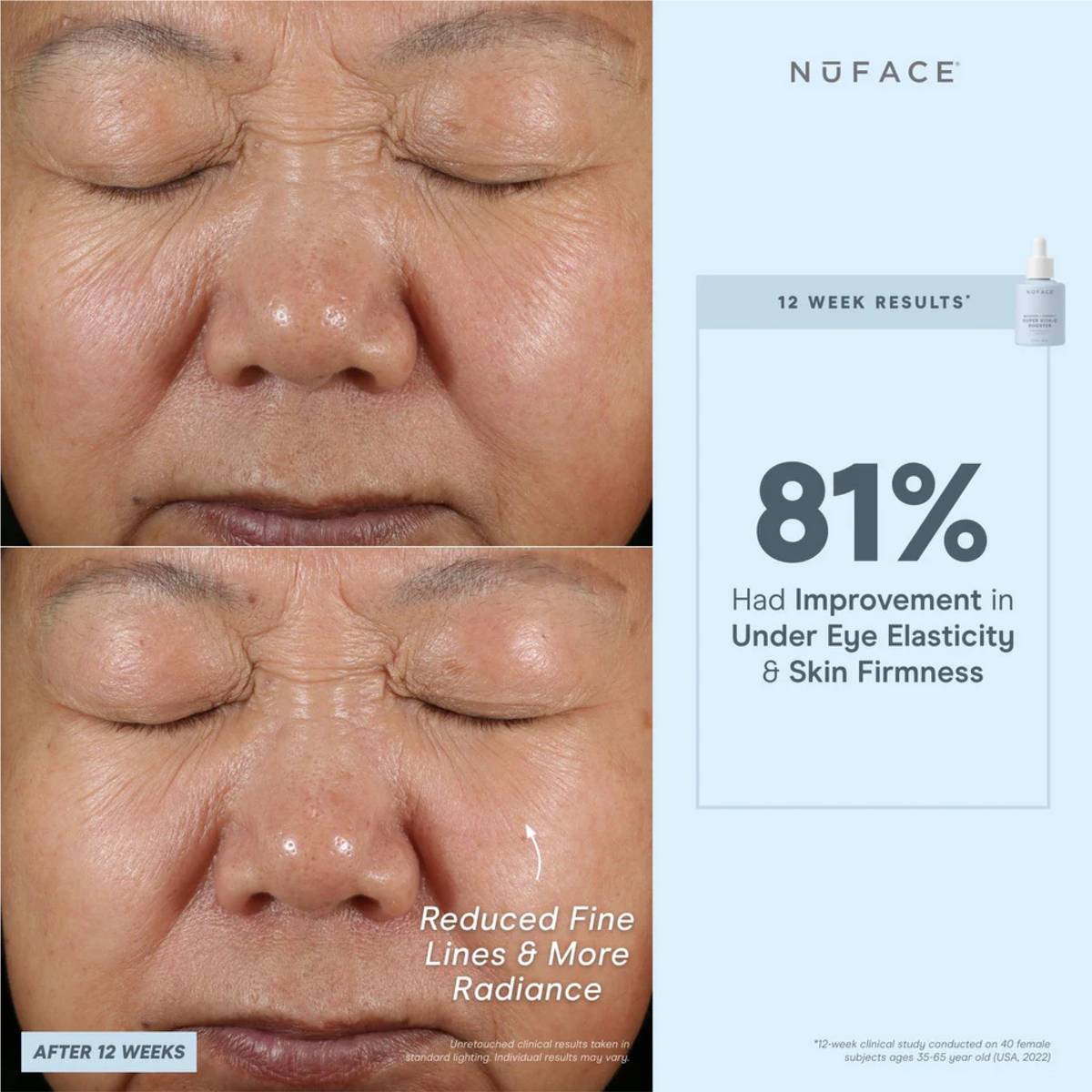 NuFACE Super Vita-C Booster Serum 5mL
