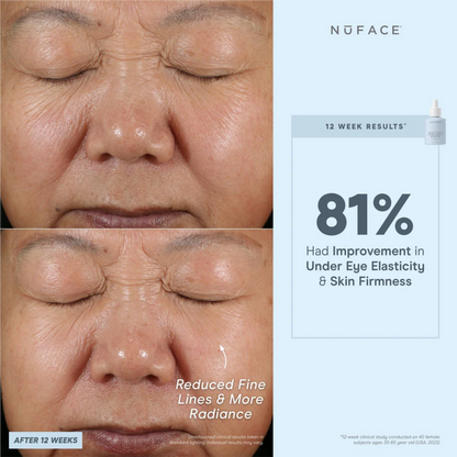 NuFACE Super Vita-C Booster Serum