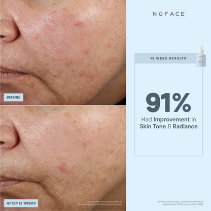 NuFACE Super Vita-C Booster Serum