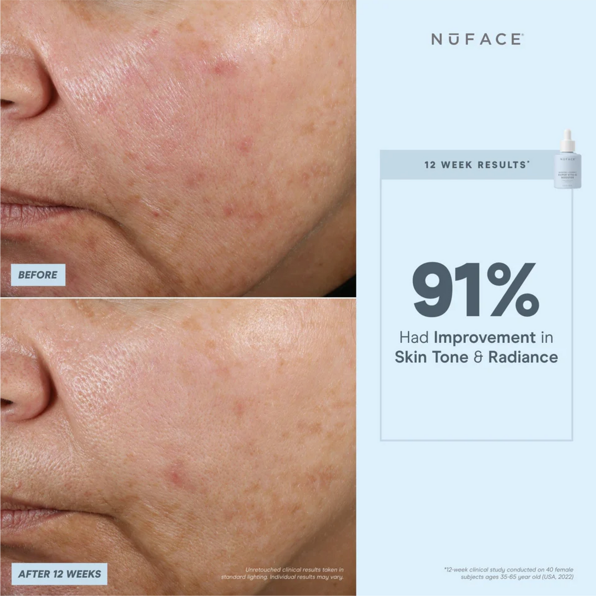 NuFACE Super Vita-C Booster Serum 5mL