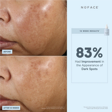 Sérum booster NuFACE Super Vita-C 5 mL