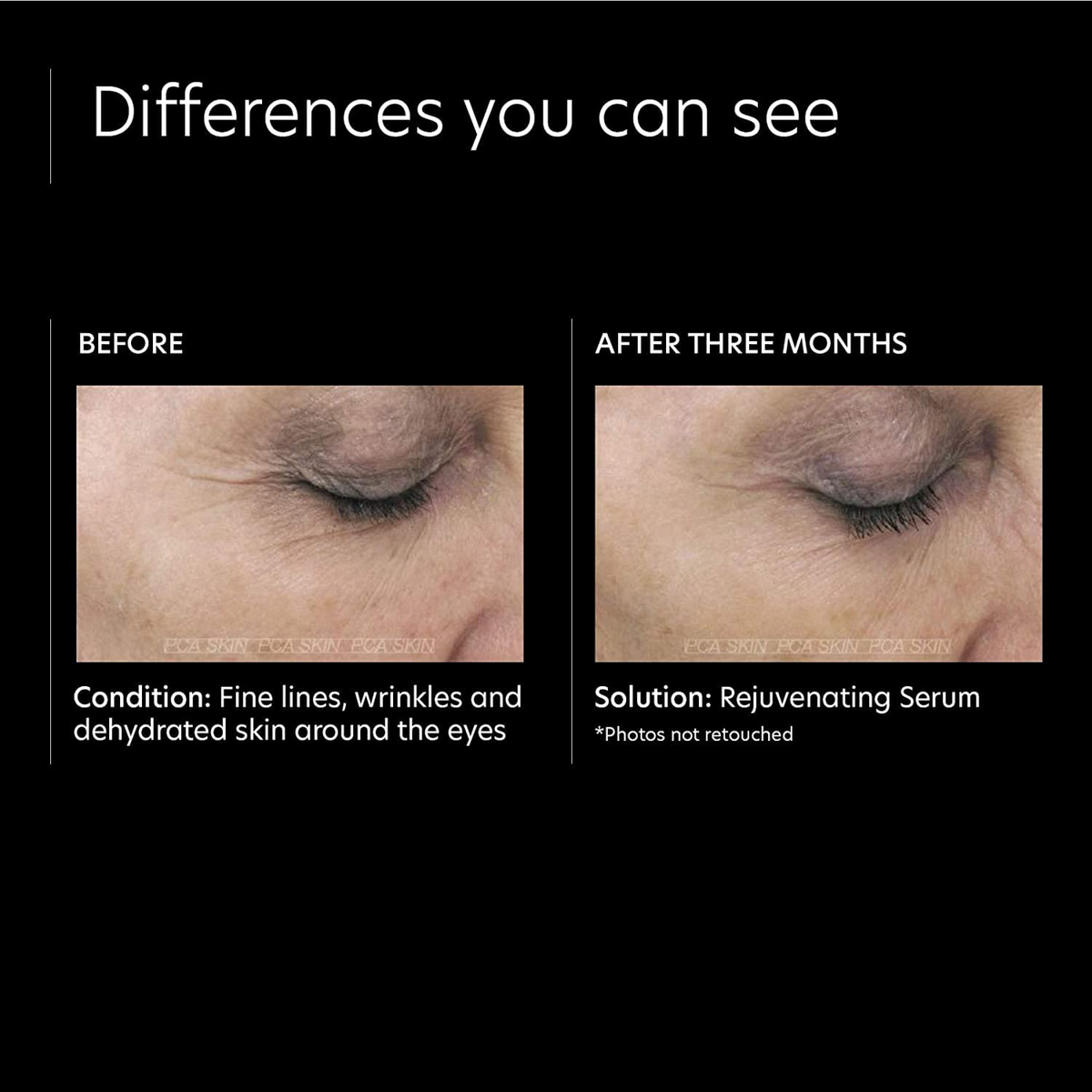 PCA Skin Rejuvenating Serum