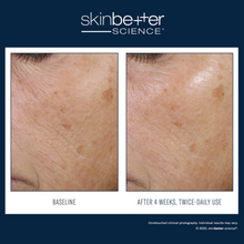 Soin hydratant rééquilibrant Trio de SkinBetter
