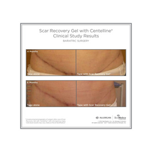Gel réparateur de cicatrices SkinMedica avec Centelline®