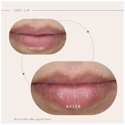 Teoxane [3D] Lip, Nourishing & Plumping Lip Care