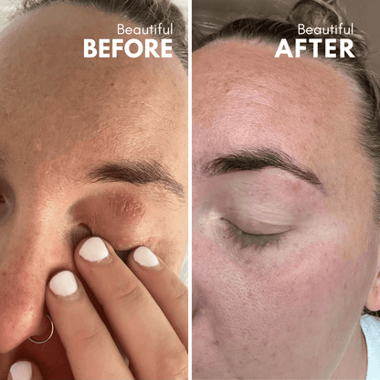 Trivolos | Eczema Cream